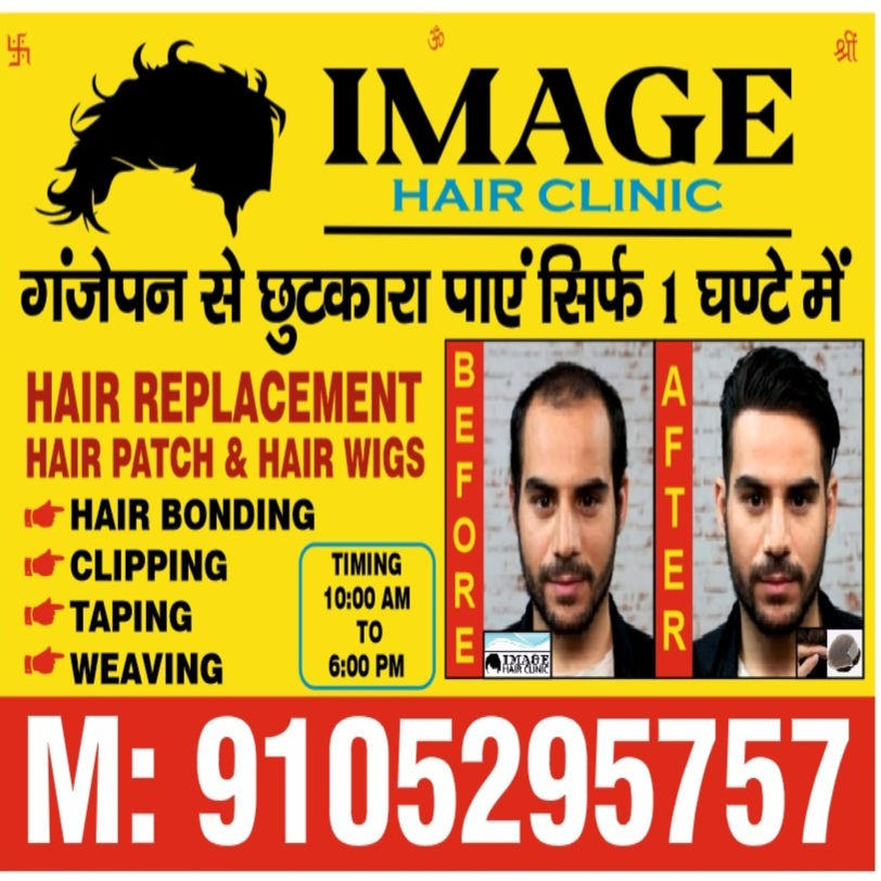 Image Hair Clinic #Hair Patch &Wig Specialist